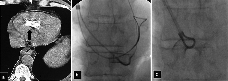 Fig. 19