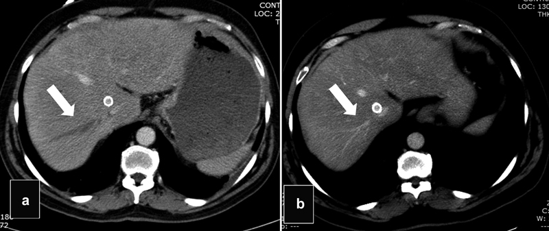 Fig. 23