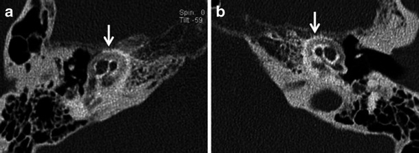 Fig. 12