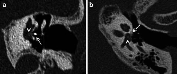 Fig. 11