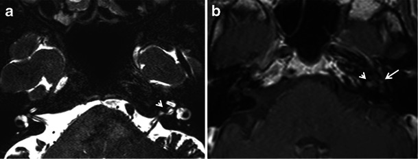 Fig. 14