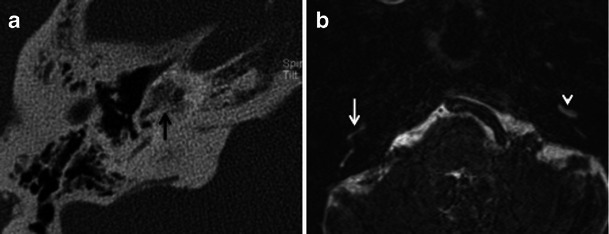 Fig. 17