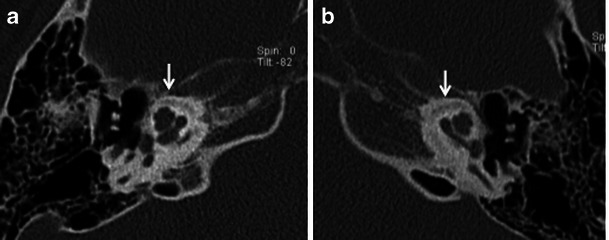 Fig. 15