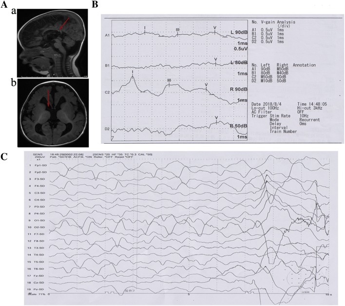 Fig. 1