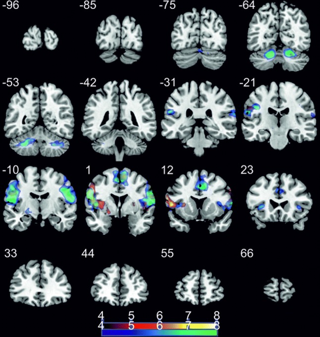 Fig. 3