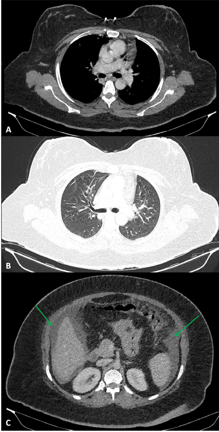 Fig 2