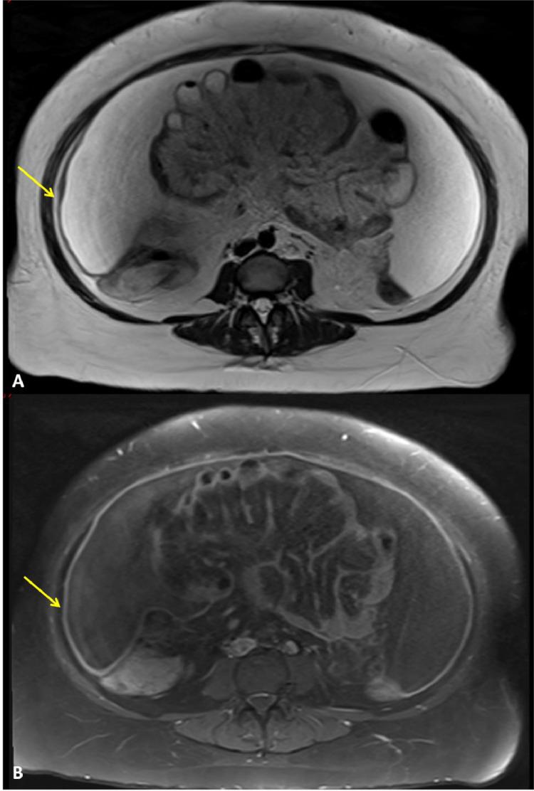 Fig 5