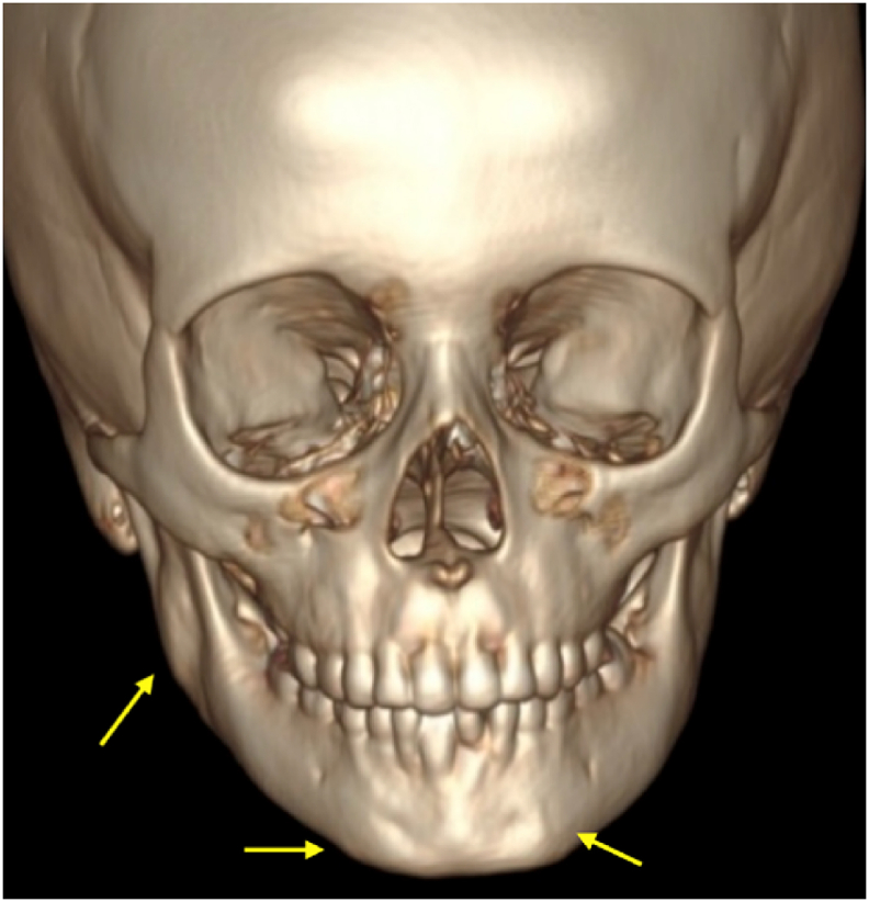 Fig. 5