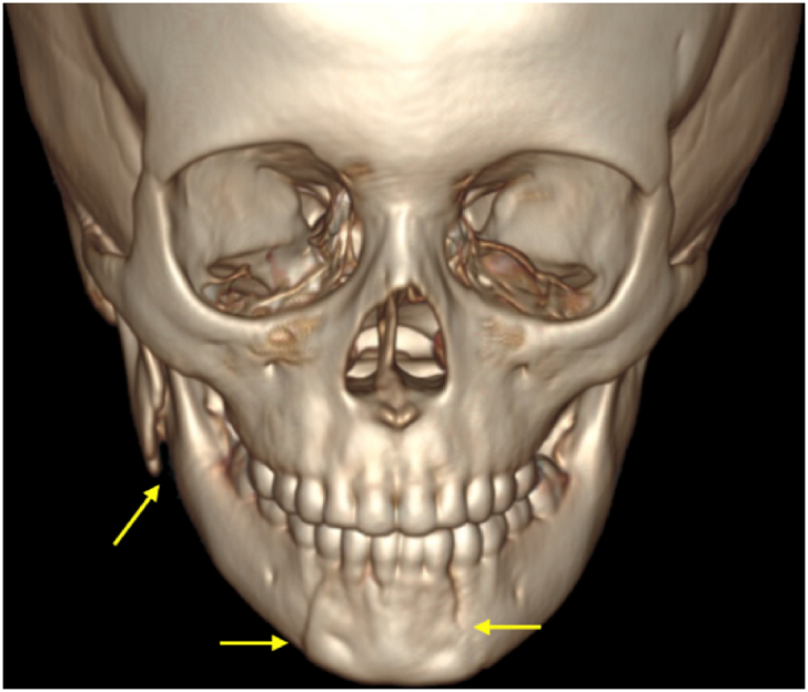 Fig. 1