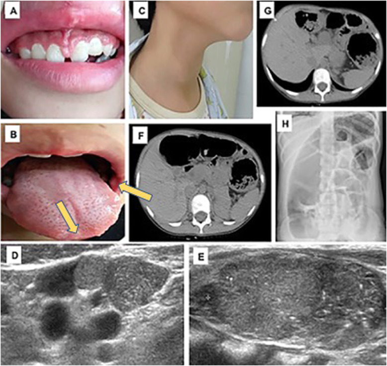 Fig. 1