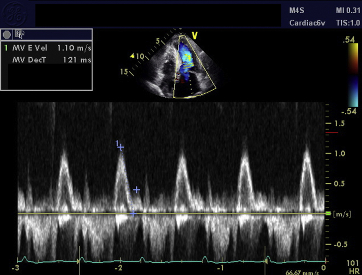 Figure 2