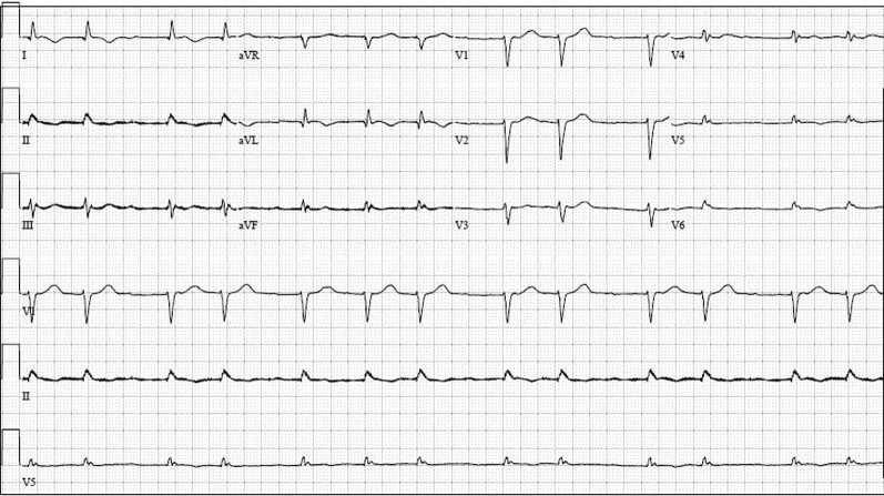 Figure 1