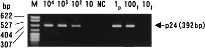 FIG. 1