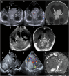 Fig. 12