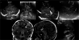 Fig. 10