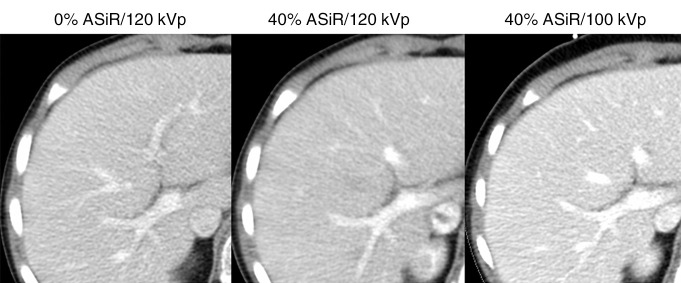 Figure 3b: