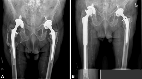 Fig. 1A–B