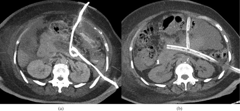 Figure 13