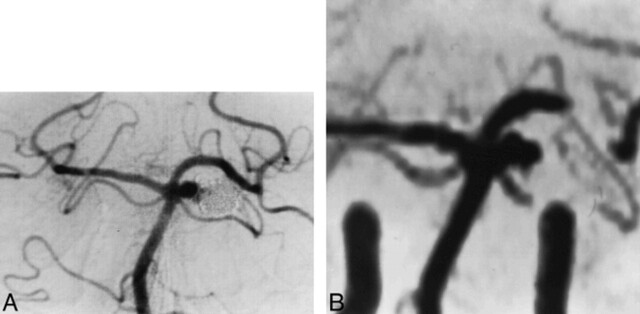 fig 3.