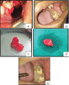 [Table/Fig-3a-e]: