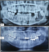 [Table/Fig-5a,b]: