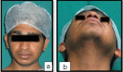 [Table/Fig-1a,b]: