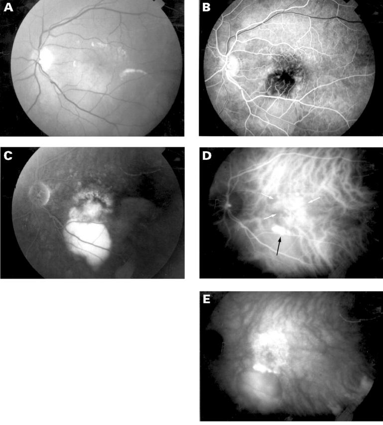 Figure 2  