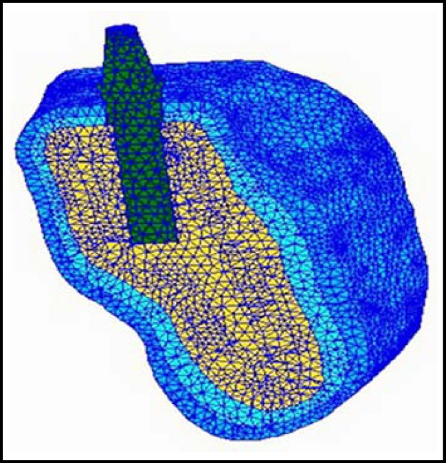 Fig.1