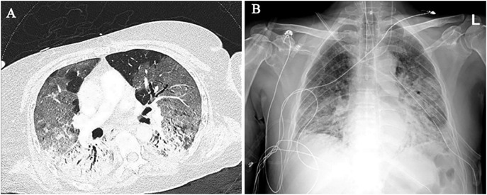 Fig. 4