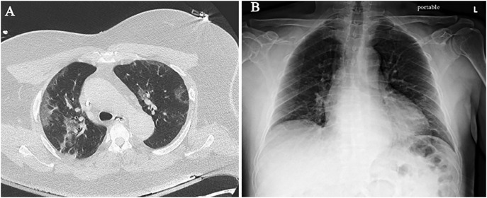 Fig. 1