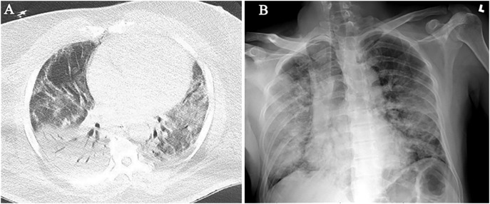 Fig. 3