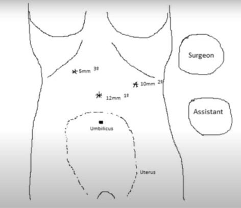 graphic file with name 464_2022_9337_Fighn_HTML.jpg