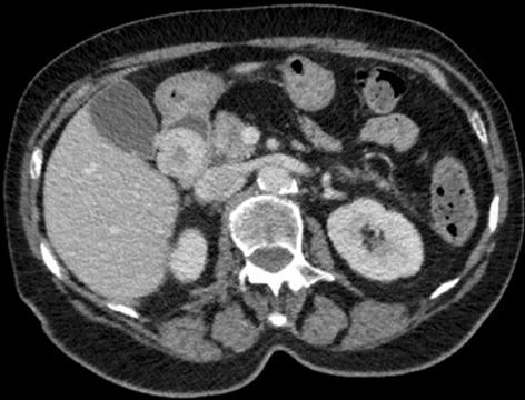 graphic file with name 464_2022_9337_Figjb_HTML.jpg