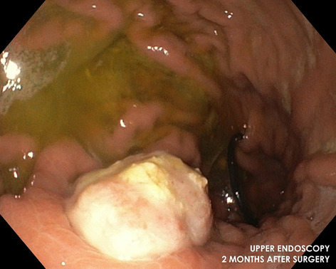 graphic file with name 464_2022_9337_Fighw_HTML.jpg