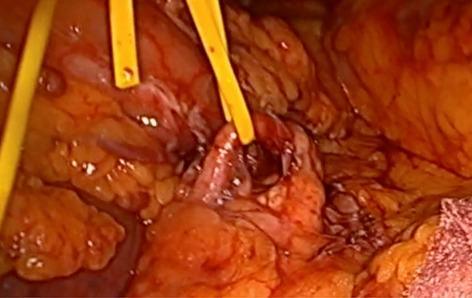 graphic file with name 464_2022_9337_Figia_HTML.jpg