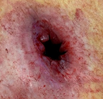 graphic file with name 464_2022_9337_Figal_HTML.jpg