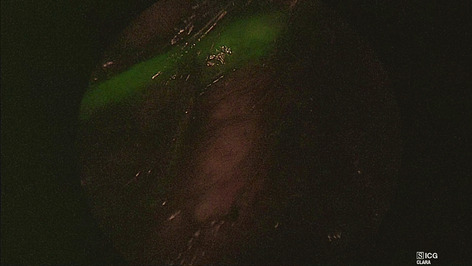 graphic file with name 464_2022_9337_Figfq_HTML.jpg