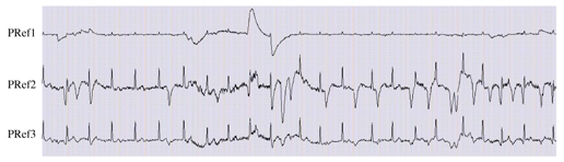 Fig. 5