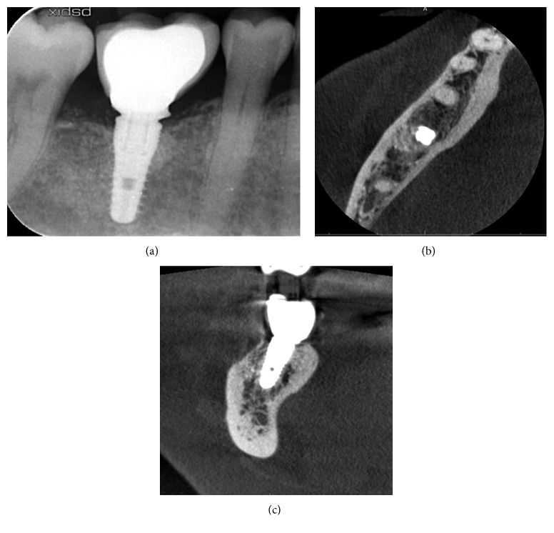 Figure 13