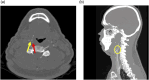 Figure 10.