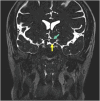 Figure 11.