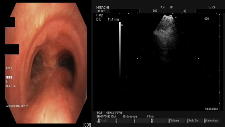 Fig. 10