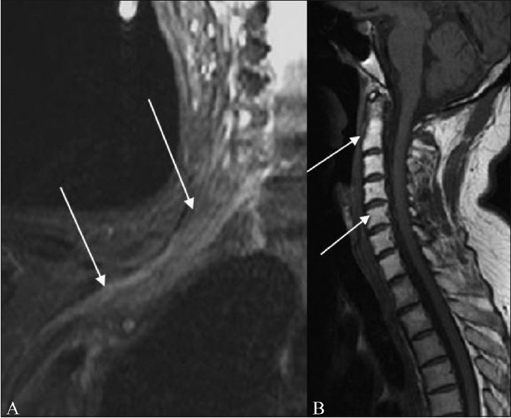 Figure 12 (A,B)