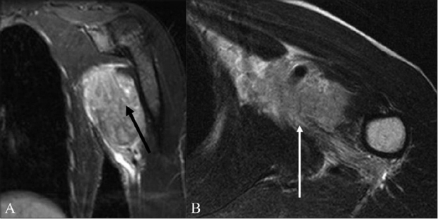 Figure 7 (A, B)