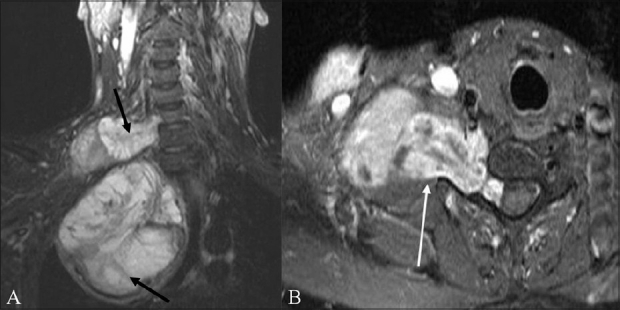 Figure 5 (A, B)