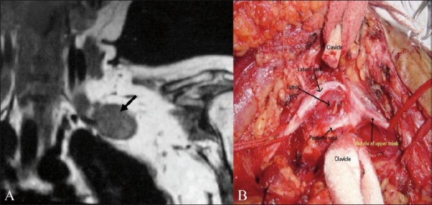 Figure 4 (A,B)