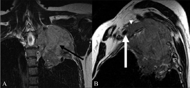 Figure 6 (A, B)