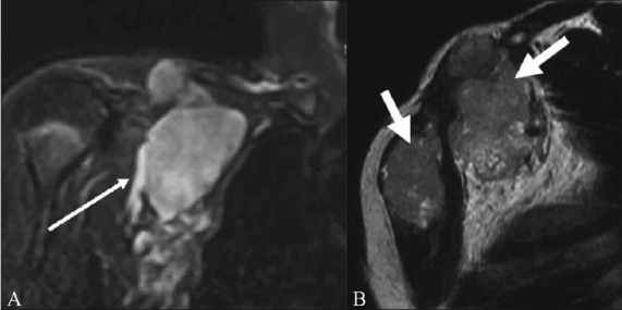 Figure 10 (A, B)