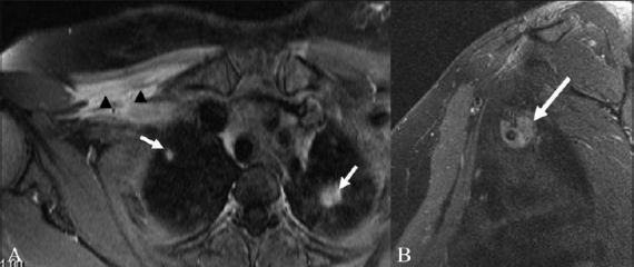 Figure 8 (A, B)