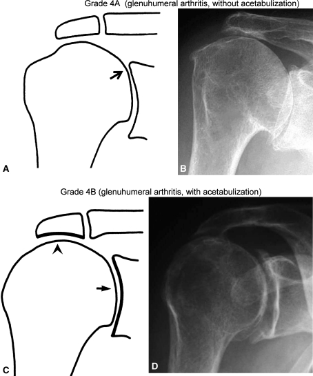 Fig. 4A–D